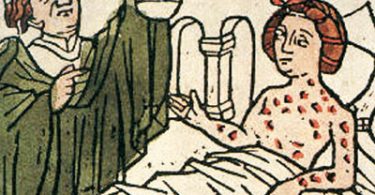 Sifilide: lo scandaloso marchio del peccato